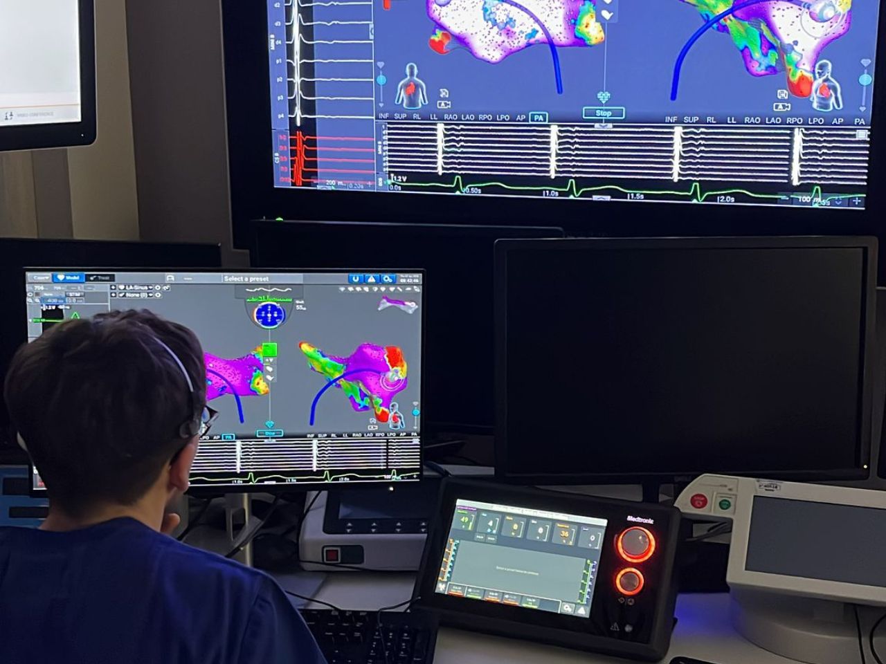 Due aritmologi di Torrette chiamati a definire le nuove linee guida internazionali sulle ablazioni